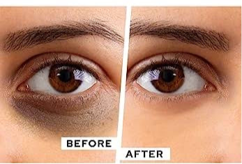 Caffeine & Multi-Vitamin Under Eye Roll-On -15ml |Erase Dark Circles |puffiness