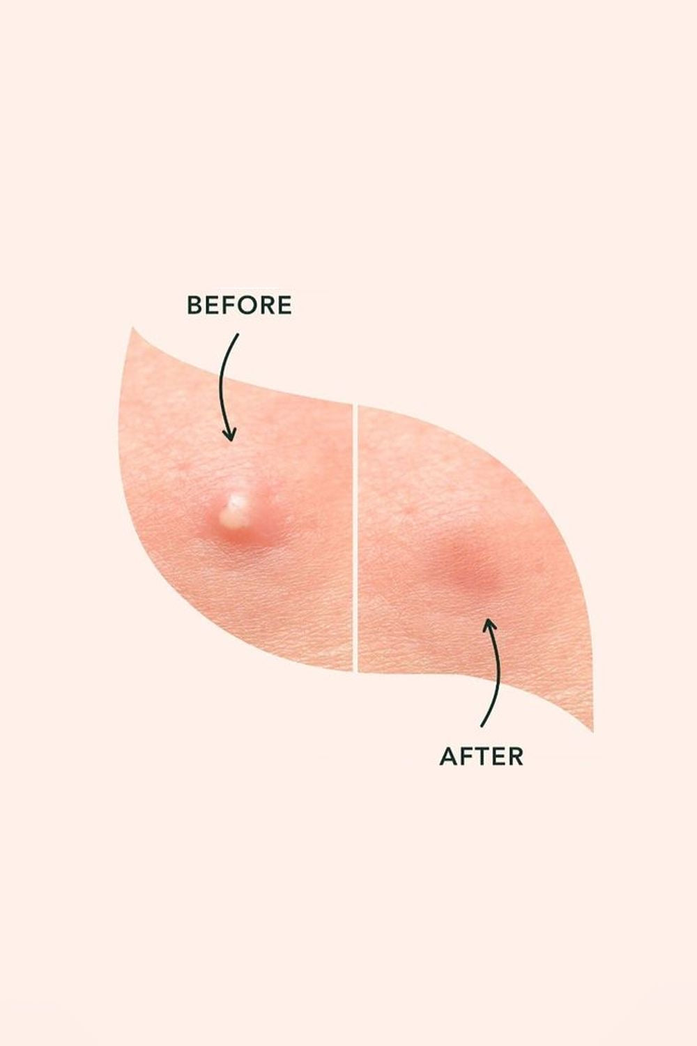 Acne clear daily facewash